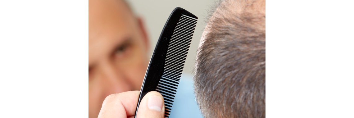 Ortica per capelli: tisane e trattamenti naturali per una chioma sana
