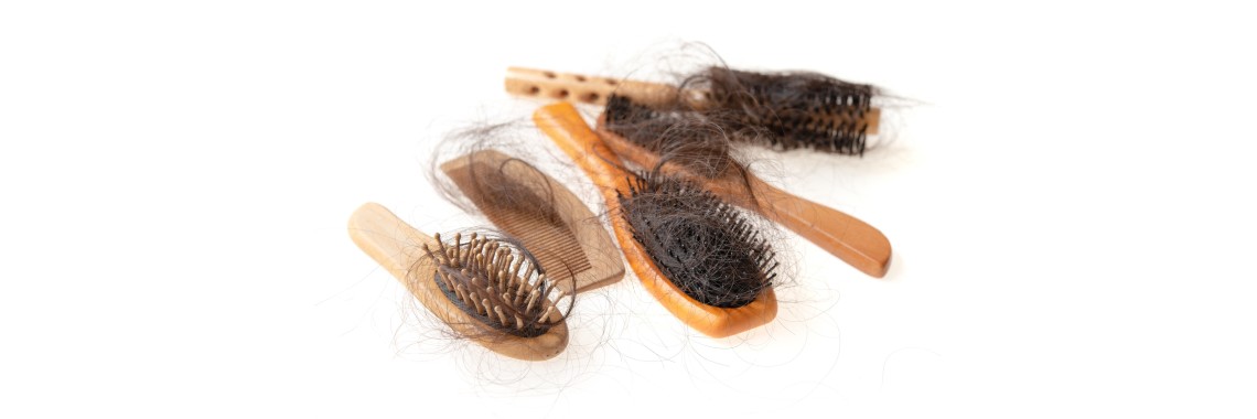 Rimedi erboristici contro la caduta dei capelli.