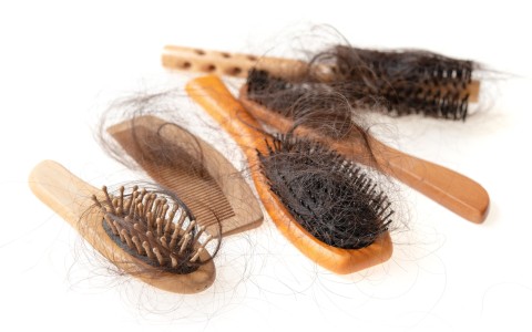 Rimedi erboristici contro la caduta dei capelli. Rimedi erboristici contro la caduta dei capelli.