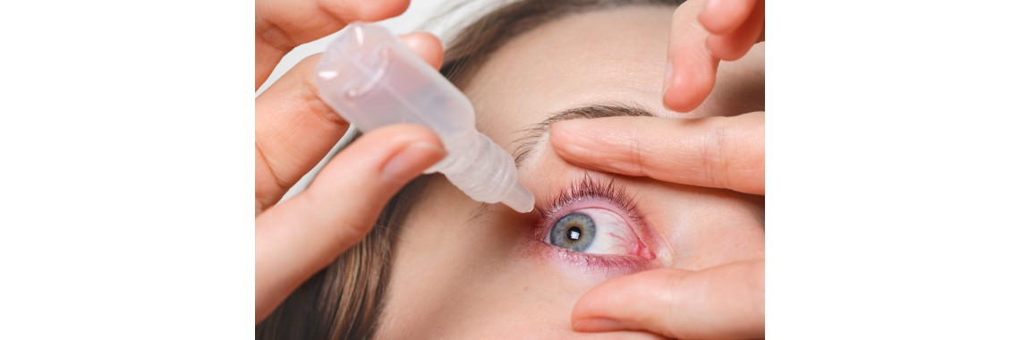 Congiuntivite come alleviare i sintomi con rimedi naturali efficaci