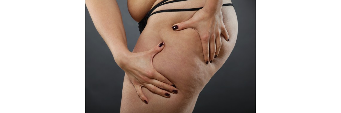Come combattere la cellulite